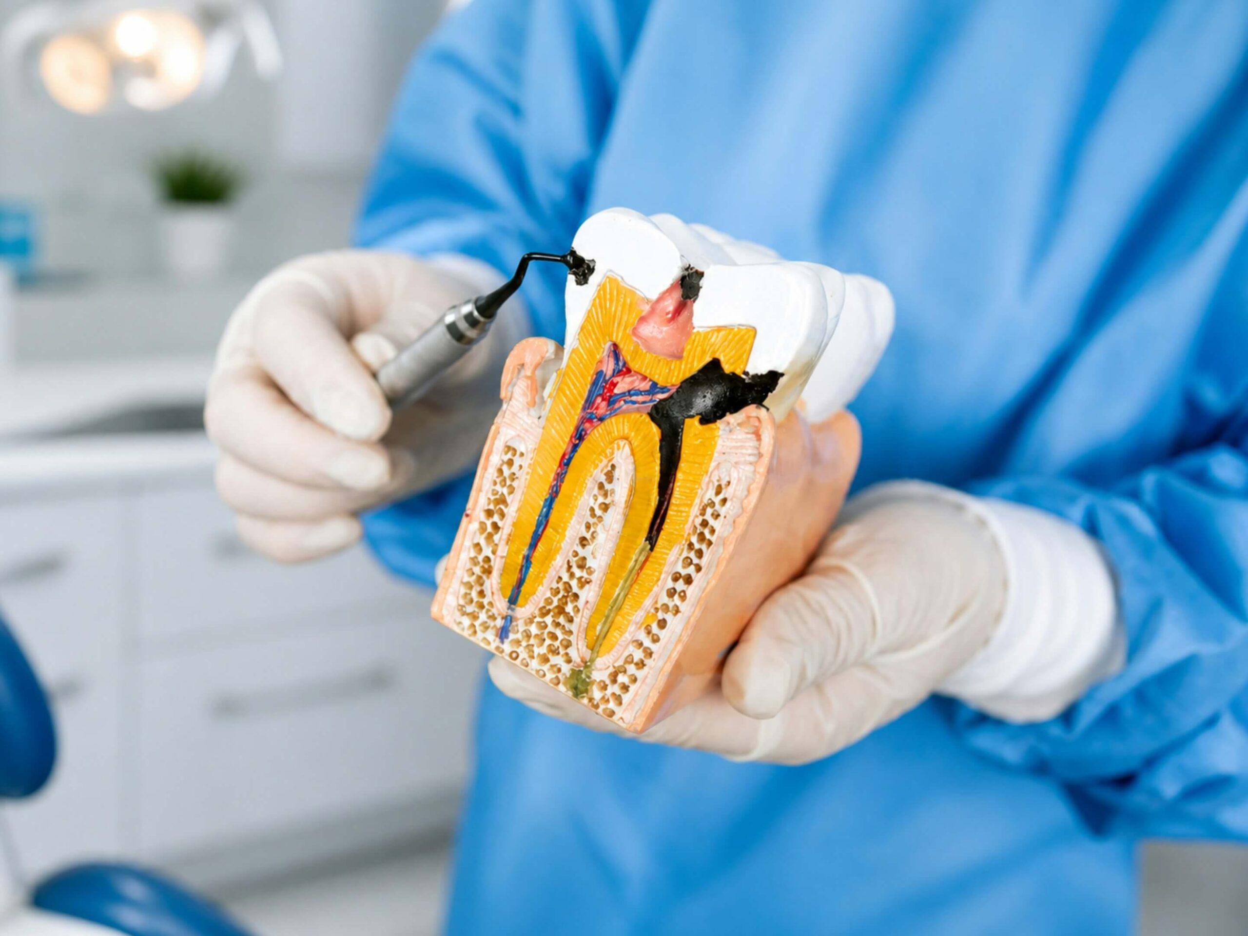 Dentist pointing to enamel on a tooth. Tooth enamel loss