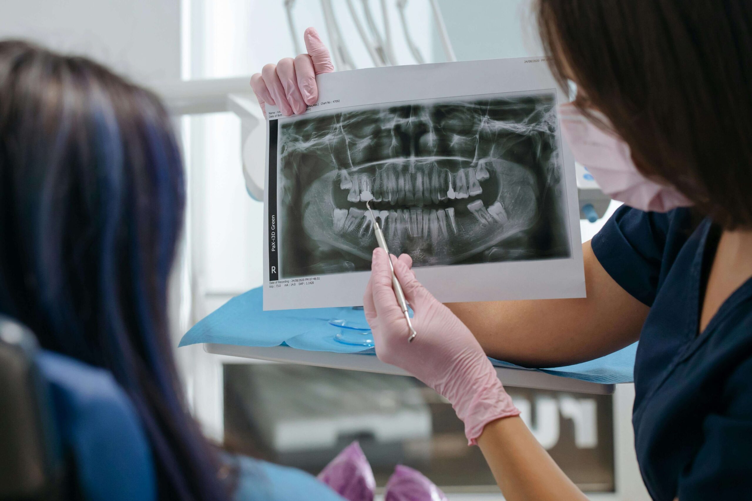 xray of patient with missing tooth Chinook mall family dental