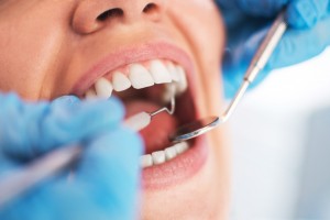 Open female mouth during oral checkup at the dentist. Selective focus.
